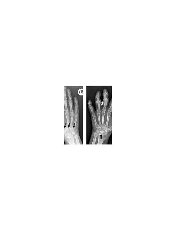 Rummy FAQ: What Does a Strong Early Hand Actually Mean?